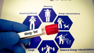 أنواع الحساسية