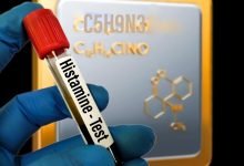 عدم تحمل الهيستامين