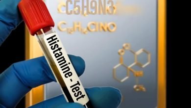 عدم تحمل الهيستامين