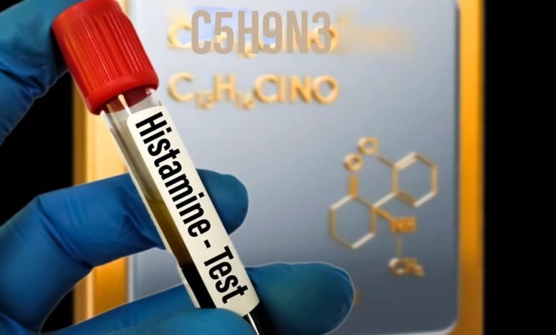 عدم تحمل الهيستامين