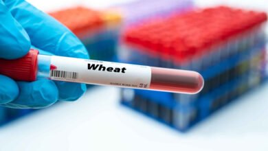 تحليل حساسية القمح