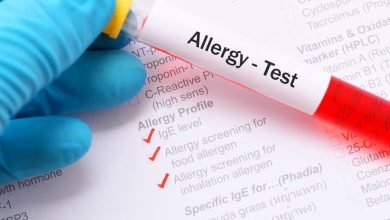 فحوصات الحساسية