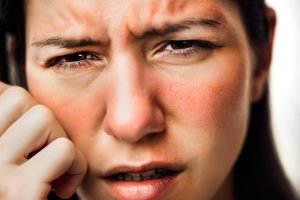 حساسية الشمس