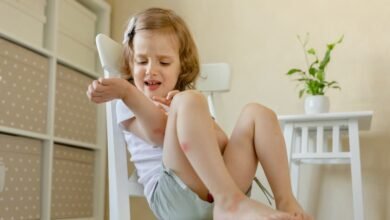 حساسية الحشرات