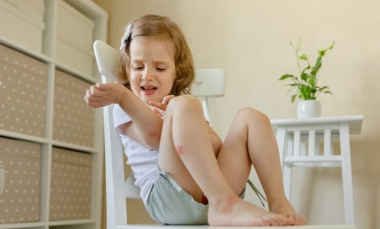 حساسية الحشرات