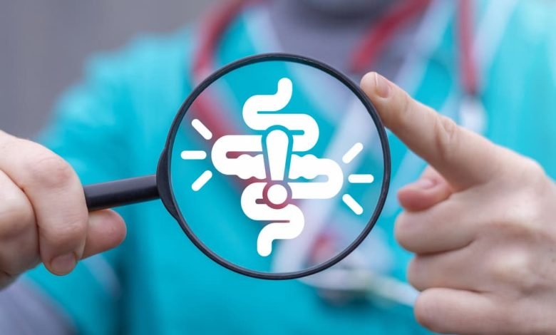 القولون العصبي