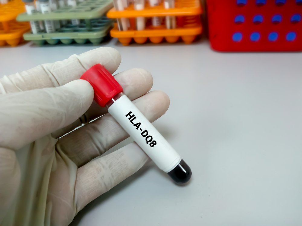 تحليل حساسية القمح