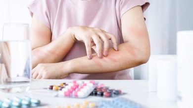 علاج الحساسية