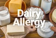 علاج حساسية الحليب عند الرضع