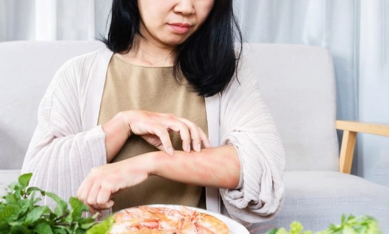 حساسية القشريات