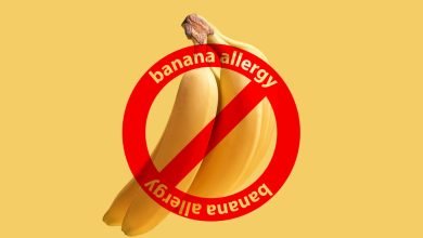 حساسية الموز