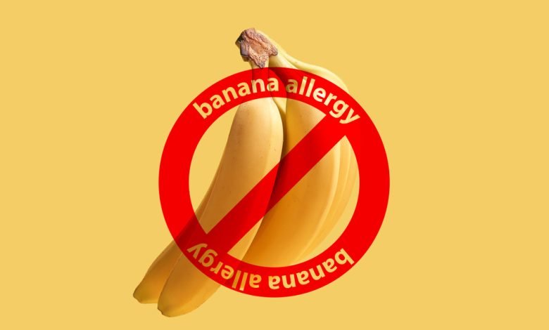 حساسية الموز