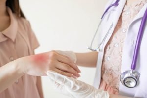 الشفاء من الحساسية