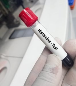 عدم تحمل الهيستامين