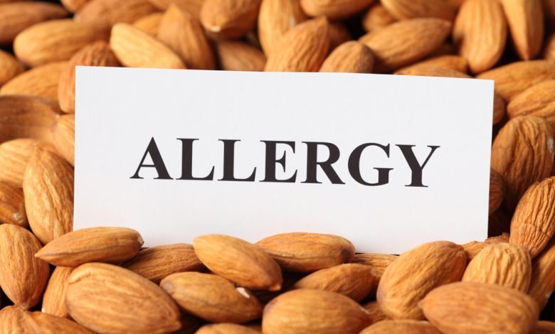 حساسية المكسرات