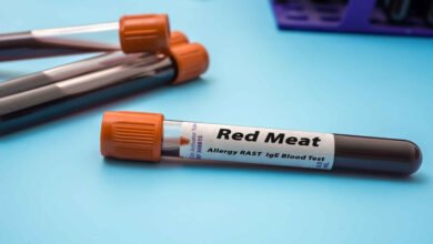 حساسية اللحم البقري