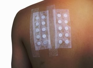 فحوصات الحساسية