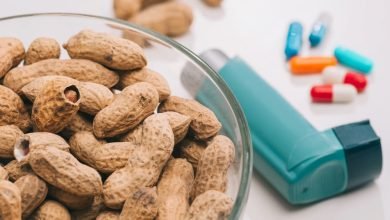 علاج حساسية الفول السوداني