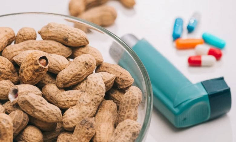 علاج حساسية الفول السوداني