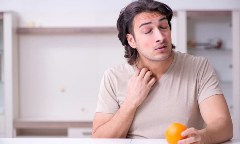 متلازمة حساسية الفم