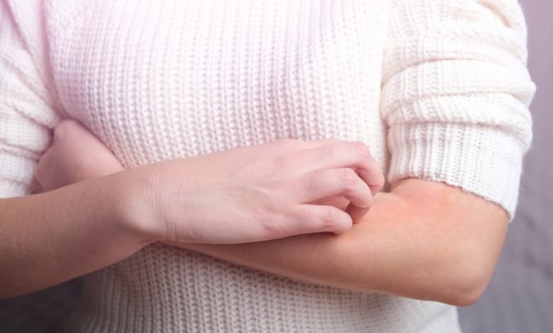 حساسية الصوف